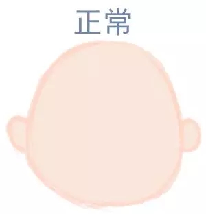 宝宝圆头好还是扁头好？？？？？？这些奥秘好多爸妈都不知路5.webp.jpg